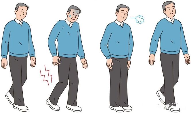 間歇性跛行 間歇性跛行