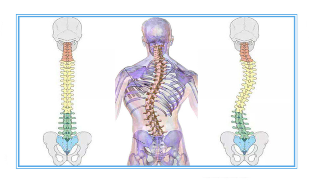 正常脊柱和脊柱側彎對比圖