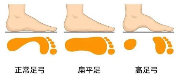 足部對比圖 足部對比圖