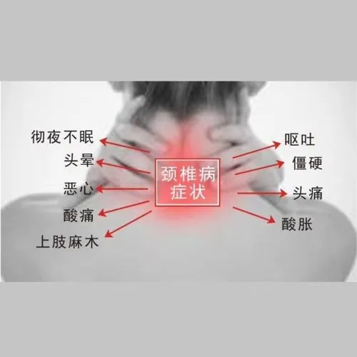 頸椎病癥狀 頸椎病癥狀