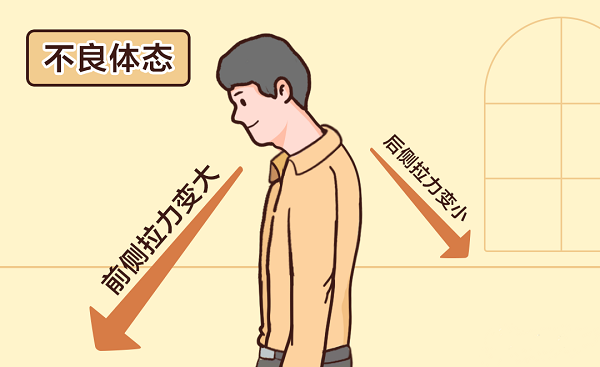 不良體態 不良體態