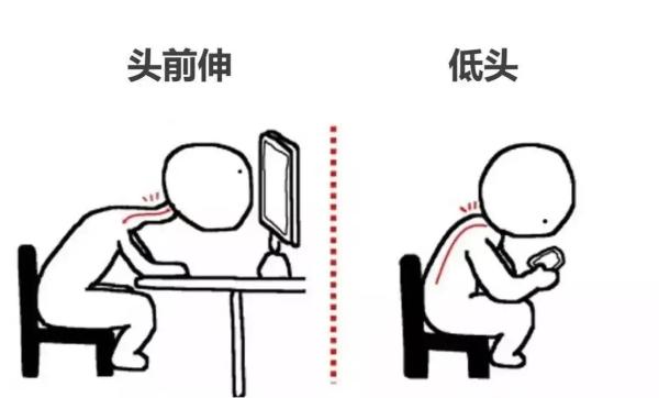 頸椎不良姿勢 頸椎不良姿勢