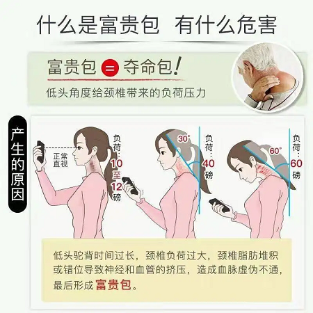 富貴包產(chǎn)生的原因