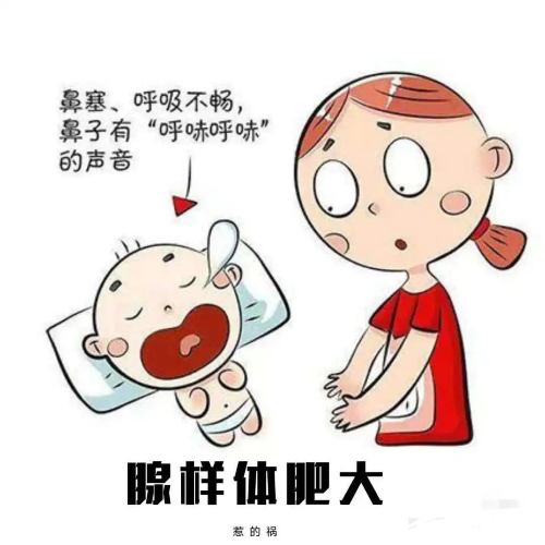 鼻塞張口呼吸 鼻塞張口呼吸