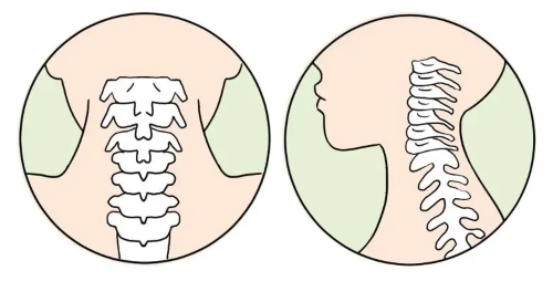 頸椎 頸椎