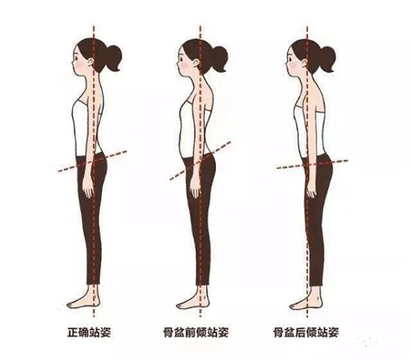 骨盆前傾后傾 骨盆前傾后傾
