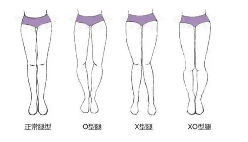 腿型 腿型