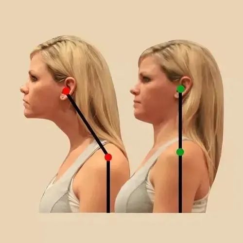 自測圓肩 自測圓肩