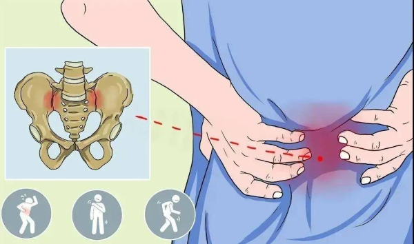 骶髂關節疼痛 骶髂關節疼痛