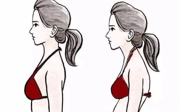 含胸弓背 含胸弓背