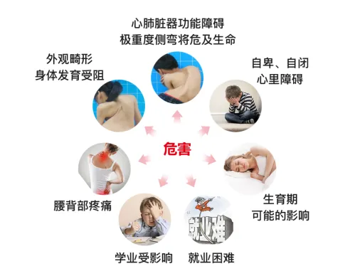 脊柱側彎危害 脊柱側彎危害